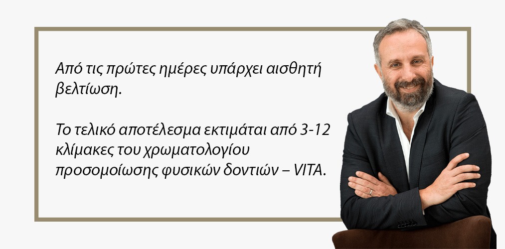 λευκανση-δοντιων
