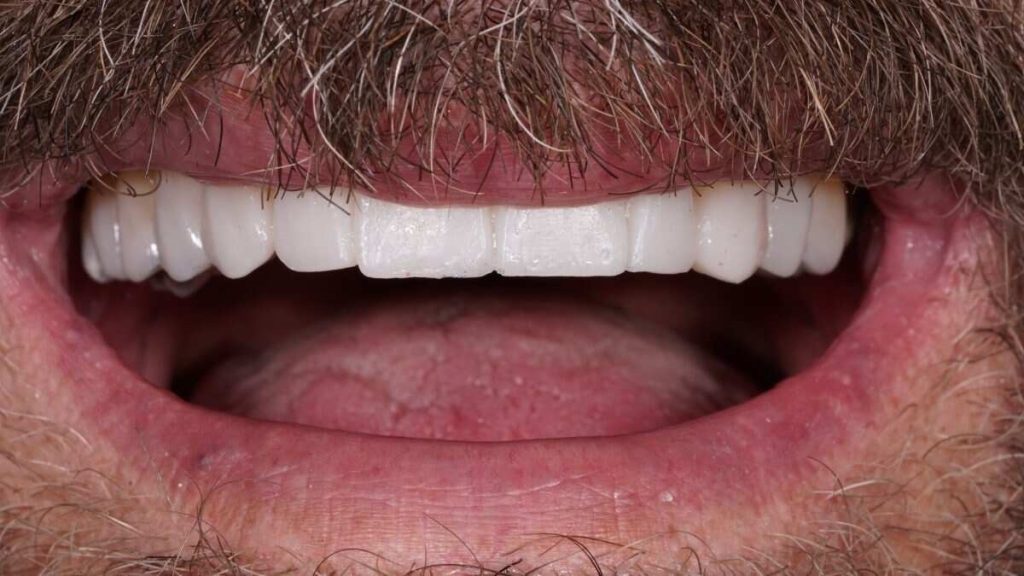 Prosthodontics