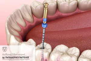 endodontia