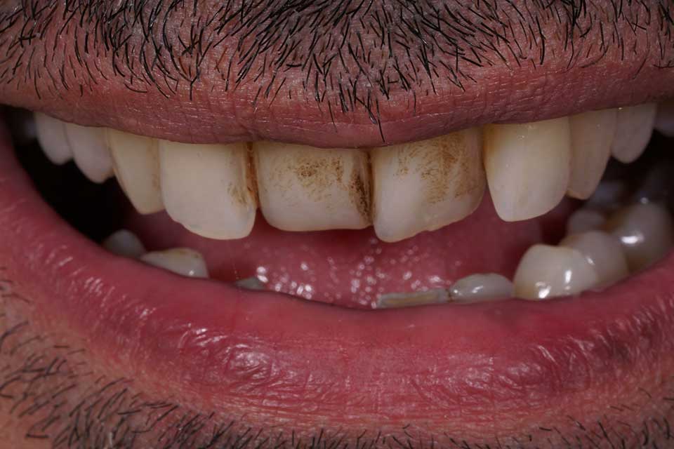 1-prosthodontics-vs-orthodontics