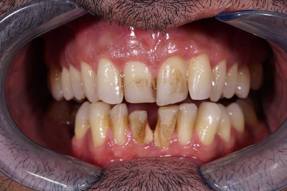 2-prosthodontics-vs-orthodontics