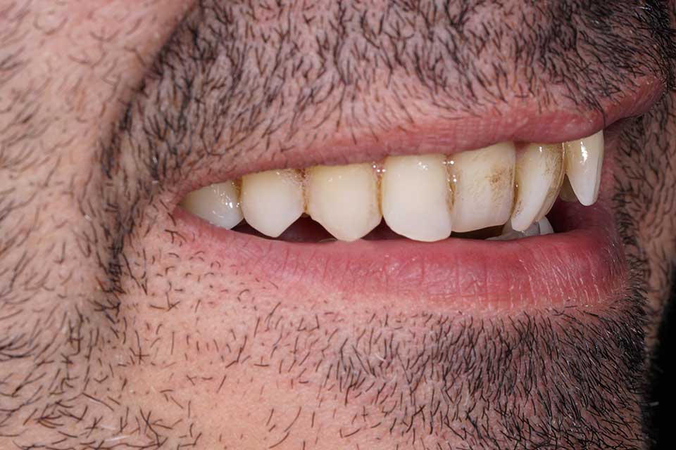 4-prosthodontics-vs-orthodontics