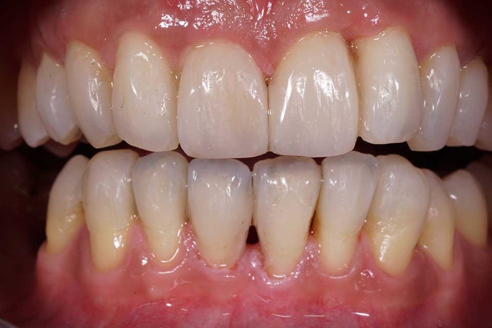 6-prosthodontics-vs-orthodontics