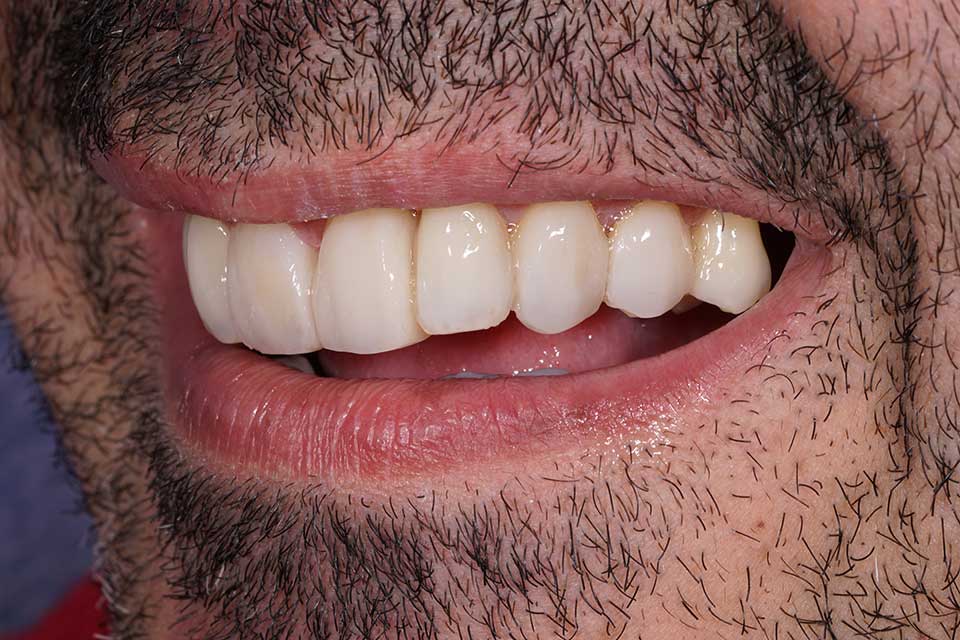 7-prosthodontics-vs-orthodontics