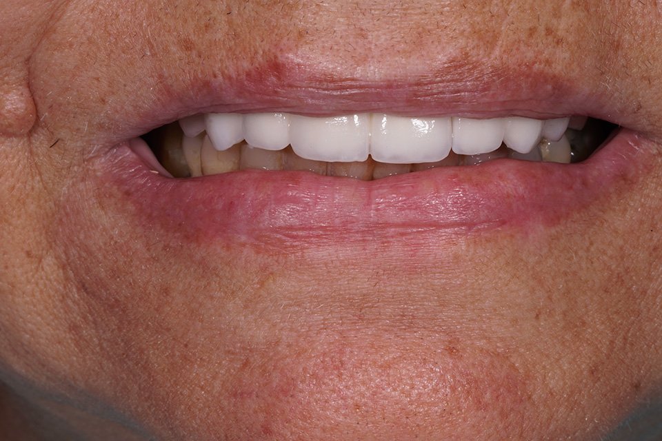 dsc03205
