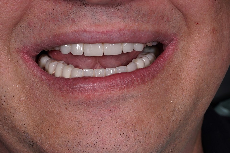 dsc04039